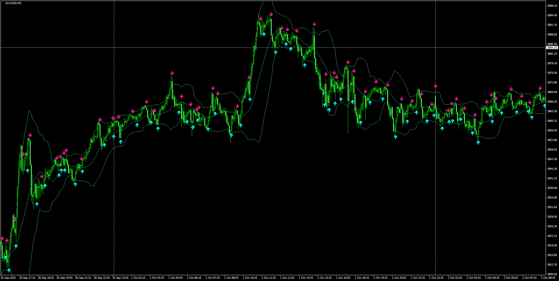 XAUUSD(M5)_2025.10.02_202452.png