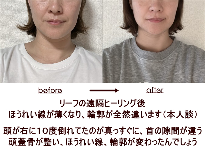 houreiRinkaku.jpg