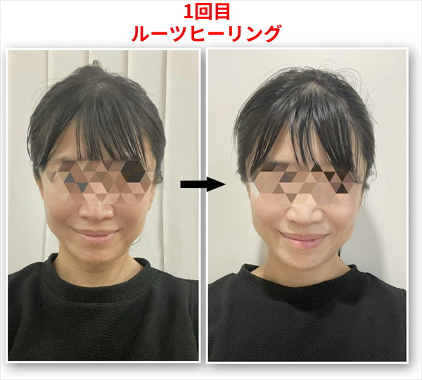 訂正版：1回目ルーツヒーリング後.jpg