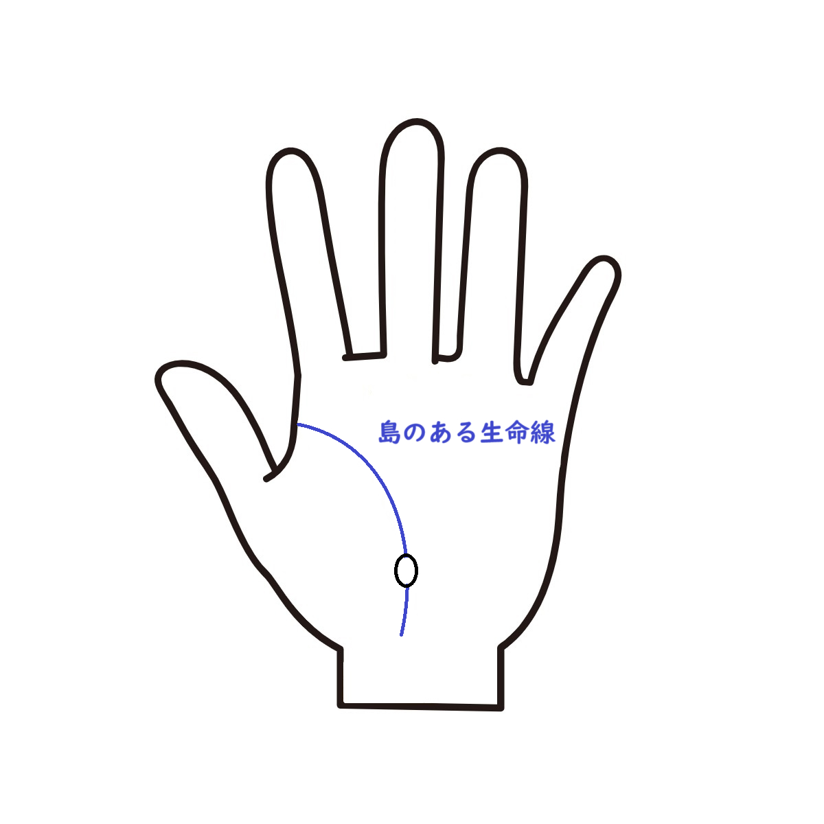 島のある生命線.png