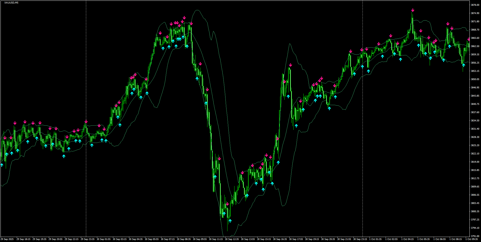 XAUUSD(M5)_2025.10.01_201420.png