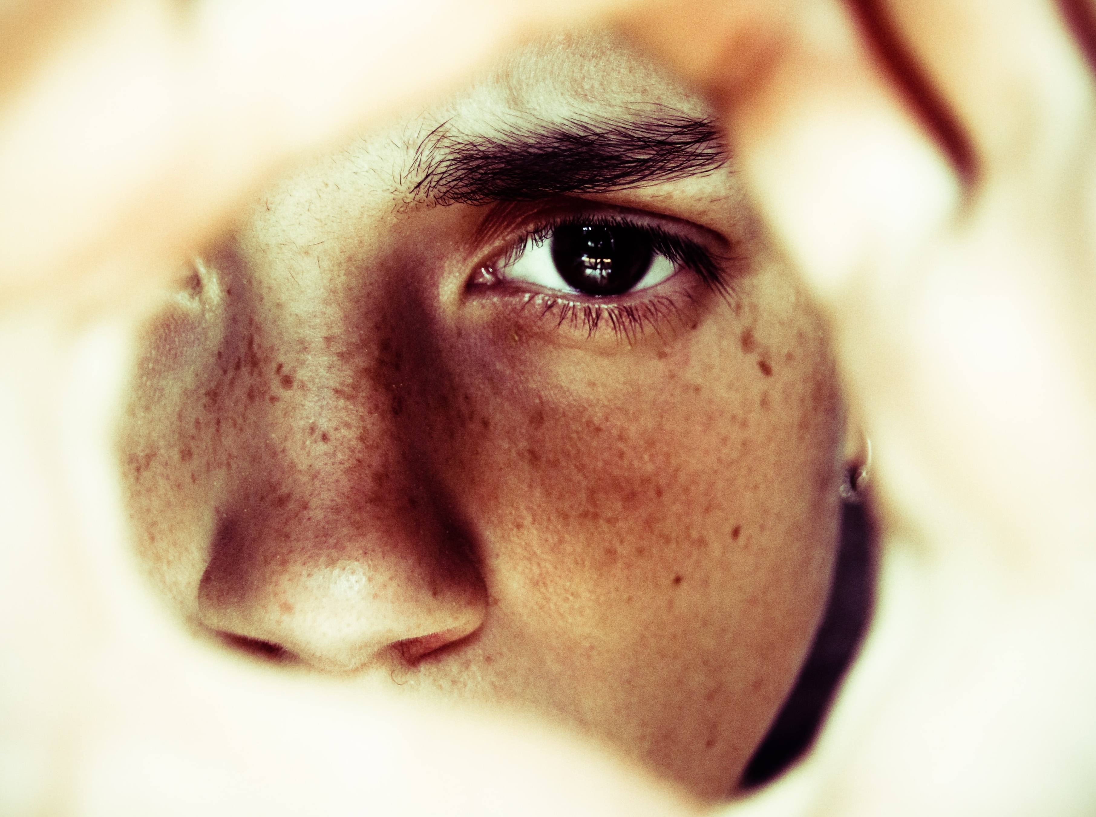 顔のシミ.jpg