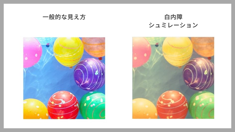 白内障.jpg