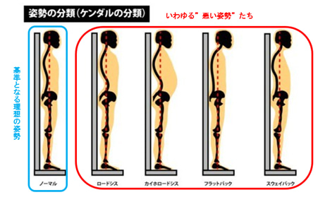 不良姿勢.jpeg