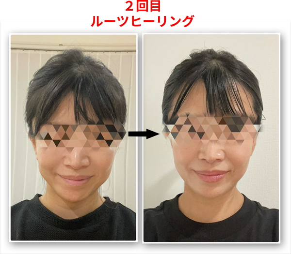 訂正版：２回目ルーツヒーリング後.jpg