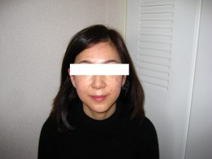 アフター-300x225.jpg