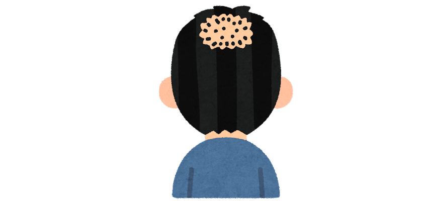 頭頂部の薄毛のイラスト.png