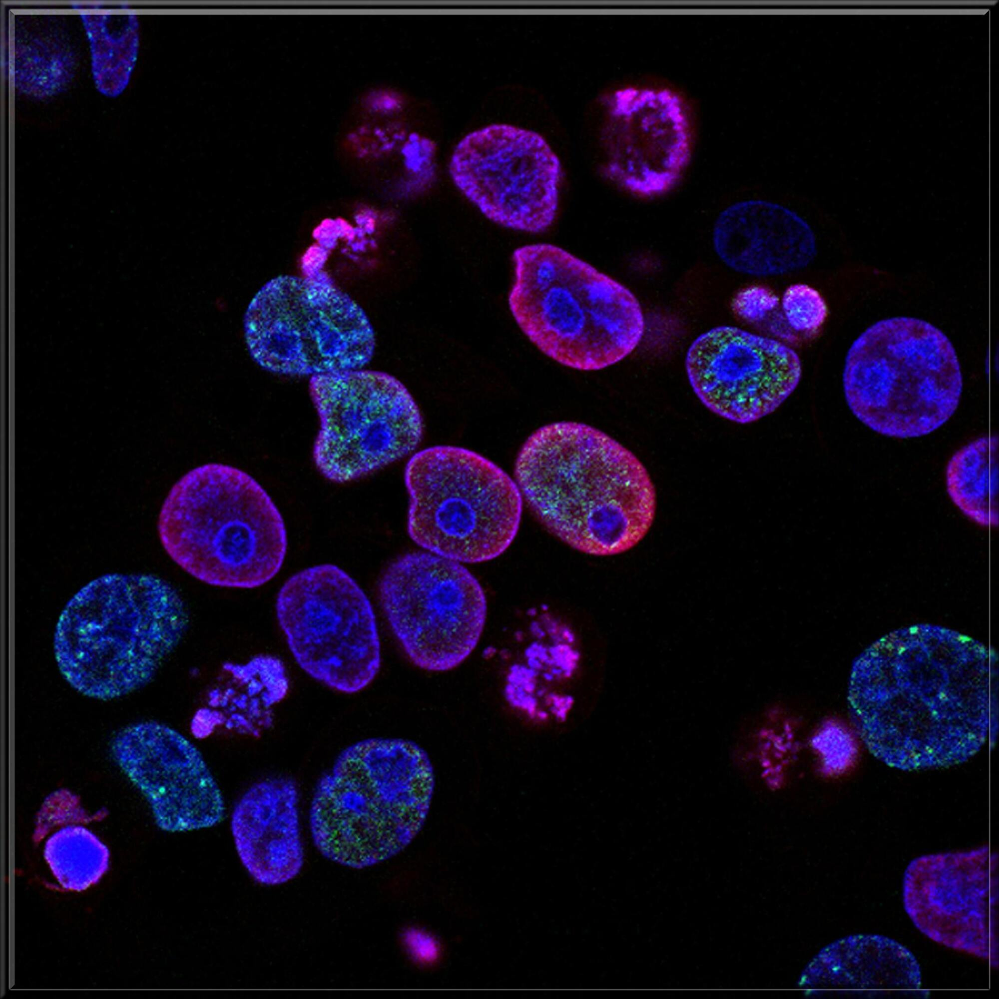 national-cancer-institute-L7en7Lb-Ovc-unsplash.jpg