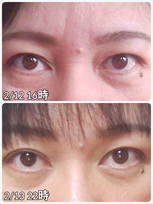 eyeEkubosan.jpg