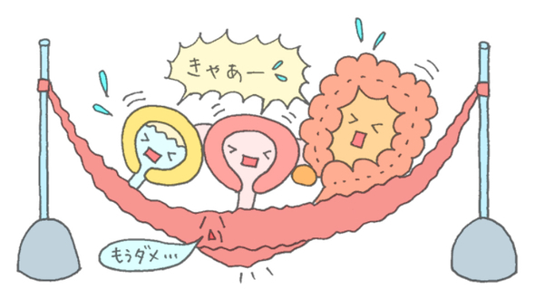 骨盤臓器脱.jpeg