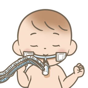挿管赤ちゃん.png