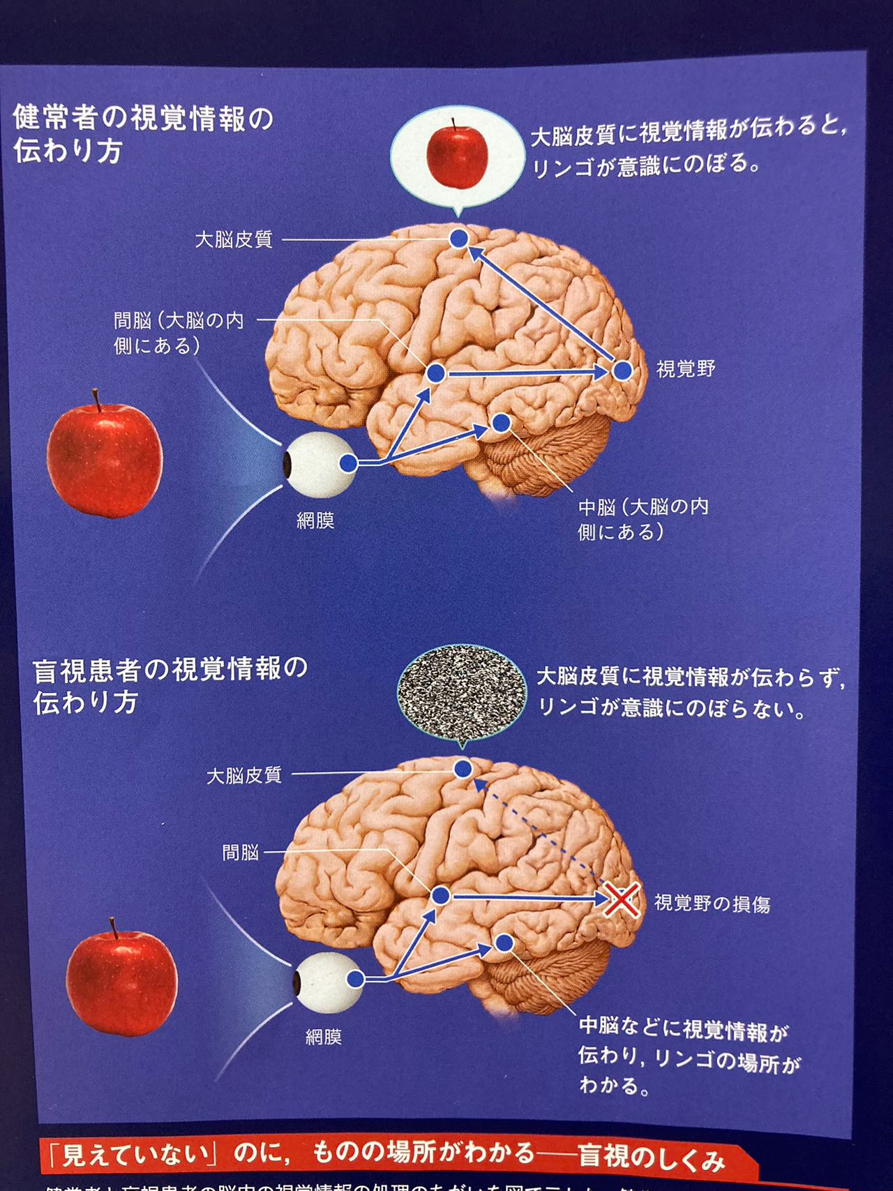 盲視.jpg