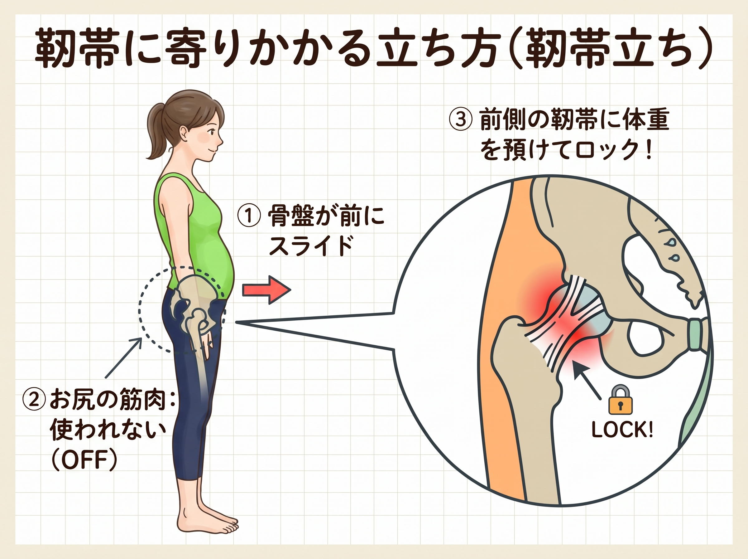 スウェイバック 靭帯立ち.jpg