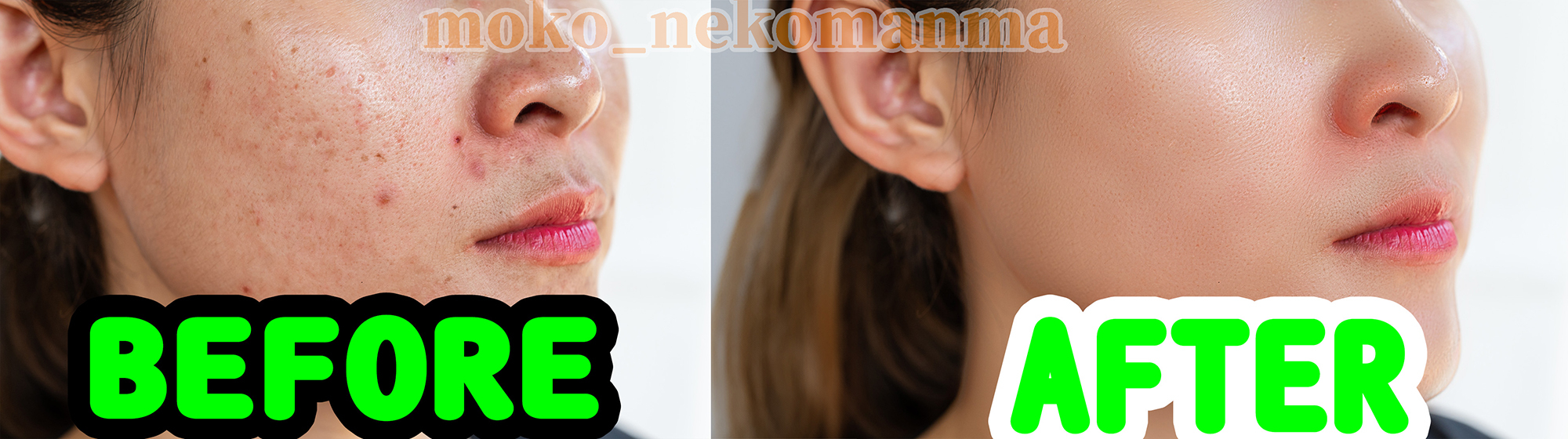 レタッチニキビ修正サンプル画像.jpg