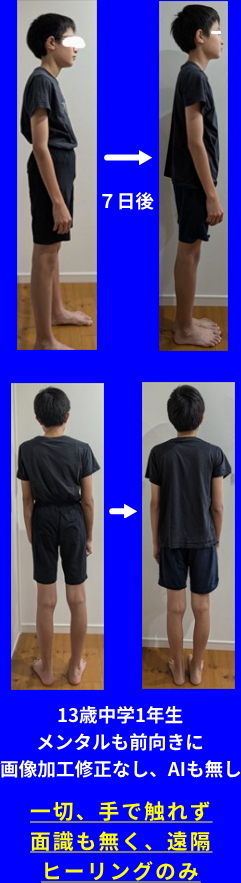 ２S.N5Body.jpg